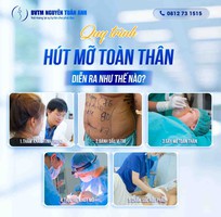 Quy trình hút mỡ toàn thân diễn ra như thế nào