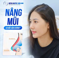 Nâng mũi phong thuỷ có thật sự đổi vận không