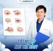 Cắt mí có thay đổi vận mệnh không