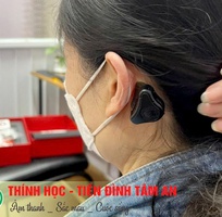 3 Máy trợ thính đường xương Adhear