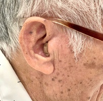 2 Máy trợ thính Prompt CIC   nhỏ gọn trong tai, mạnh mẽ trong từng âm thanh