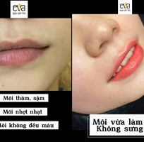 1 Môi thâm, nhợt nhạt, không đều màu, ... Đến Eva Spa nhé