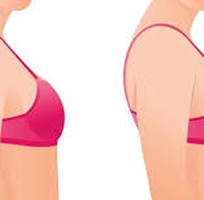 Hành trình hồi phục sau nâng ngực