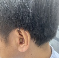 1 Máy trợ thính Intuis CIC Ix