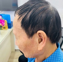 Máy trợ thính siêu nhỏ trong tai CIC