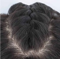 Tìm hiểu tóc giả che hói đỉnh đầu nam