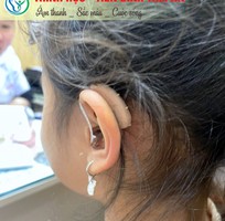4 Máy trợ thính Signia - Máy trợ thính Hải Phòng