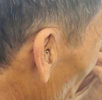 1 Tôi biết đeo trợ thính sẽ nghe rõ hơn...Nhưng ngại mọi người nhìn thấy