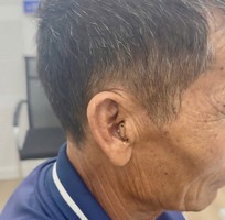 2 Tôi biết đeo trợ thính sẽ nghe rõ hơn...Nhưng ngại mọi người nhìn thấy
