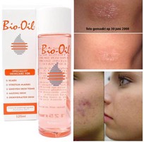 Bio-oil luôn là mặt hàng bán chạy số 1 và được khách hàng ưa thích .