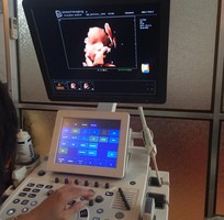 1 Máy siêu âm 4D cao cấp IUSTAR 300