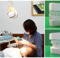 Phẫu thuật hàm vẩu - Giải pháp chữa răng vẫu hiệu quả số 1 trên TG
