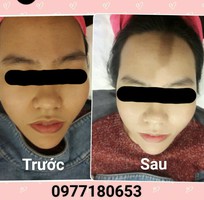 2 Chuyên sỉ lẻ Men ủ trắng mặt hoa anh đào Nhật