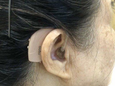 Máy trợ thính Tâm An - Máy trợ thính Prompt SP 1