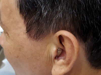 Máy trợ thính Tâm An - Máy trợ thính Prompt CIC 1