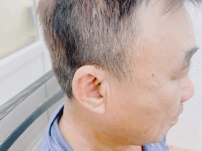 Máy trợ thính Tâm An - Máy trợ thính Intuis 3 CIC 2