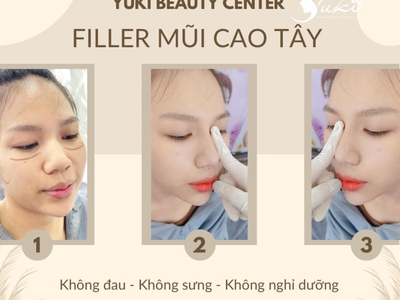 Tiêm Filler Môi Đà Nẵng tại Thanh Yuki Beauty Center 1