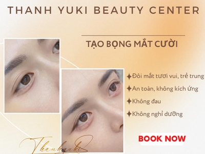 Tiêm Filler Môi Đà Nẵng tại Thanh Yuki Beauty Center 5
