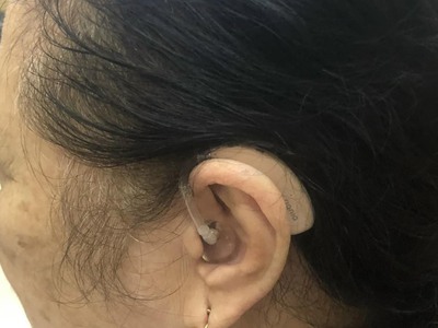 Máy trợ thính Tâm An - Máy trợ thính Motion C G X 2