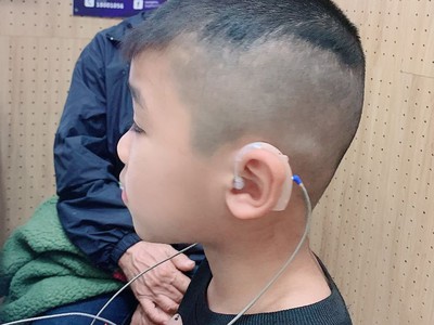 Máy trợ thính Hải Phòng - nghe kém ở trẻ em 2