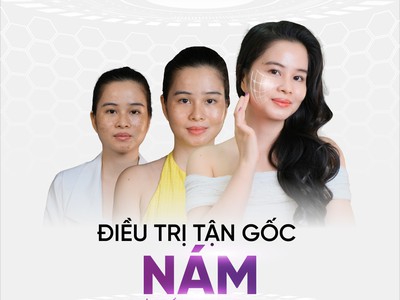 Trị nám số 1 tại tp.HCM - Spa Thẩm Mỹ viện Lê Hoài 2