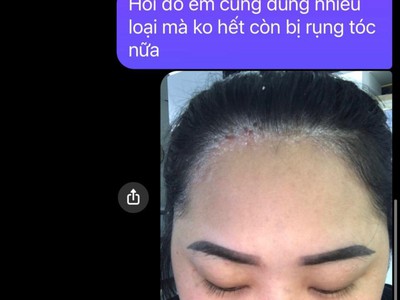 Dầu gội đầu của Úc  2