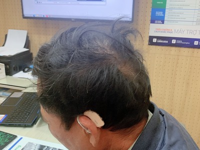 Máy trợ thính hải phòng - sửa chữa máy trợ thính 3