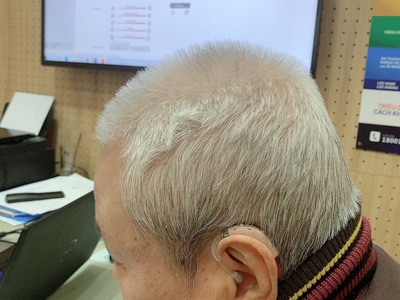 Máy trợ thính hải phòng - sửa chữa máy trợ thính 6