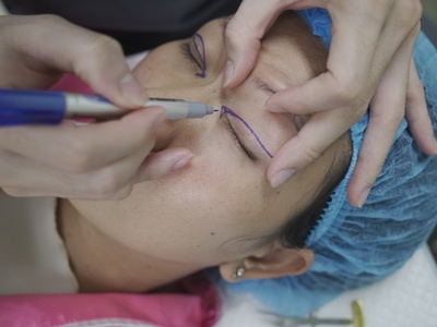 Cấy collagen thủy phân - Phương pháp làm đẹp da an toàn và hiệu quả 0