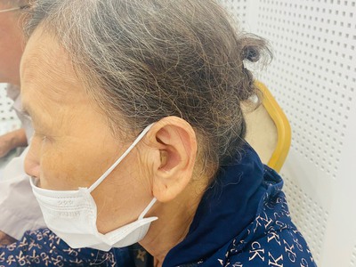 Các Kiểu Dáng Đeo máy Trợ Thính 1