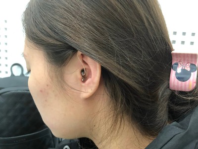 Các Kiểu Dáng Đeo máy Trợ Thính 2