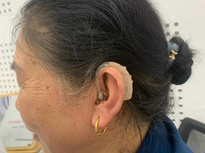 Các Kiểu Dáng Đeo máy Trợ Thính 3