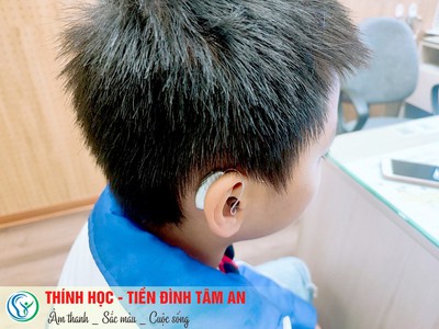 Máy trợ thính hải phòng - Mua máy trợ thính 4