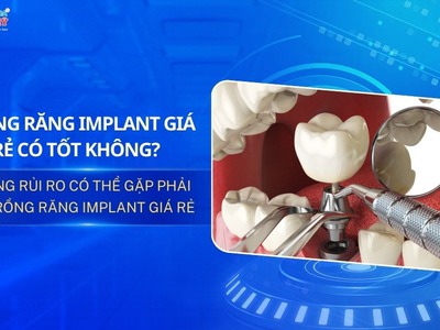 Trồng răng Implant giá rẻ có nên không  Rủi ro là gì 0