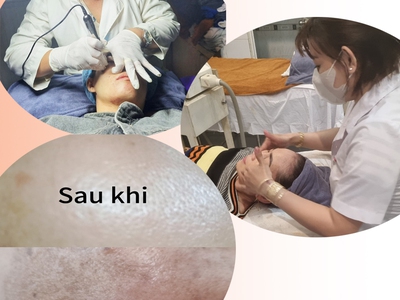 Chi phí học nghề spa: Một cái nhìn toàn diện 2