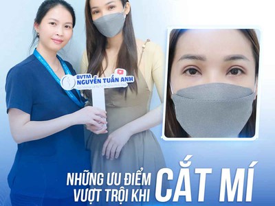 Những ưu điểm vượt trội khi cắt mí tại BVTM Nguyễn Tuấn Anh 0