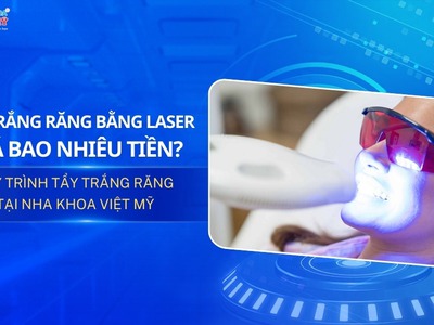 Giá Tẩy Trắng Răng Laser Bao Nhiêu  Cập Nhật Mới Nhất 0