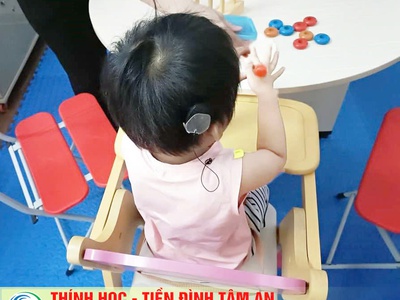 Đo thính lực cho trẻ em, điếc bẩm sinh, can thiệp cho trẻ điếc bẩm sinh 4