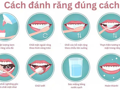 Cách đánh răng đúng, ngăn ngừa mảng bám, bảo vệ răng chắc khỏe 0