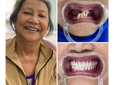 Địa chỉ làm răng uy tín tại quận Tân Bình  Nha khoa Blue dental   169A Ba Vân, P.14, Q.Tân Bình, HCM 0