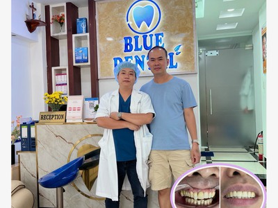 Địa chỉ làm răng uy tín tại quận Tân Bình  Nha khoa Blue dental   169A Ba Vân, P.14, Q.Tân Bình, HCM 1