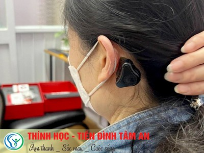 Máy trợ thính đường xương Adhear 2