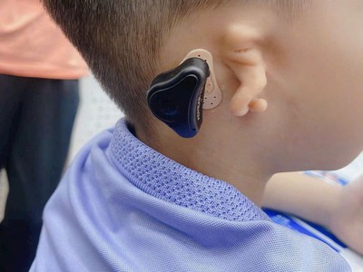 Máy trợ thính đường xương med-el adhear 0