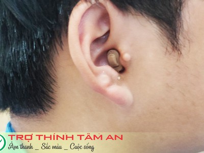 Máy trợ thính Hải Phòng - Máy trợ thính trong tai 2