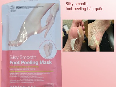 Chia sẻ kinh nghiệm lột da bàn chân  Foot Peeling 3