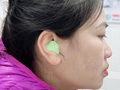 Máy Trợ Thính Tâm An Hải Dương 1
