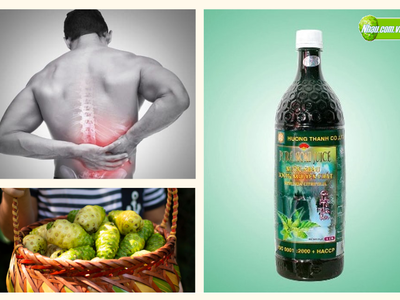 Tạm Biệt Đau Nhức Xương Khớp Với Nước Cốt Nhàu Tự Nhiên Hương Thanh  Noni Juice 0