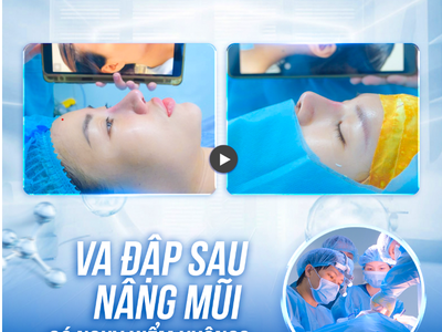Va đập sau nâng mũi 0
