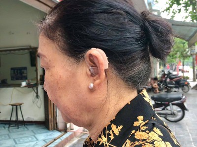 Máy trợ thính đeo sau tai SIGNIA RUN BTE - Nghe rõ mọi khoảnh khắc trong cuộc sống 3