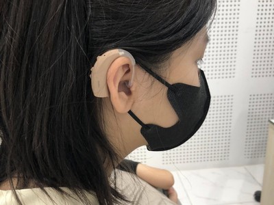 Suy giảm thính lực ở mọi lứa tuổi 0